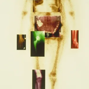 Composite of body