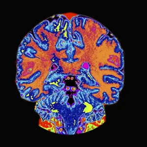 Medical Prints: Body Scans, Imaging, X-rays