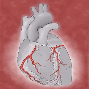Coronary Arteries, Illustration