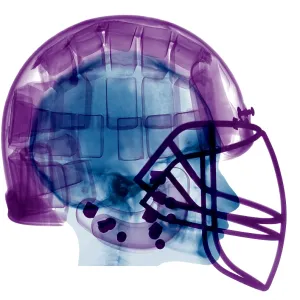Football Helmet, X-Ray Football Helmet, X-Ray