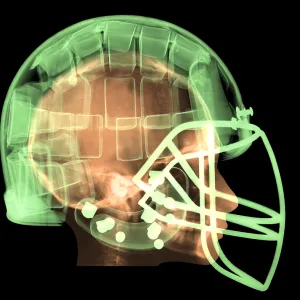 Football Helmet, X-Ray