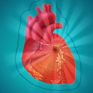 Heart Attack, Conceptual Illustration