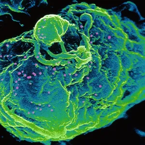 HIV infected T-cell