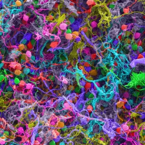 Human Brain Cells, under a microscope (SEM)