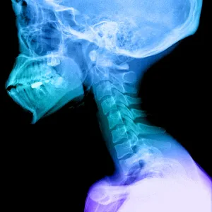 Human Skull and Cervical Spine