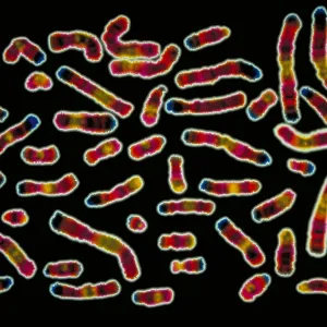 Karyotype of human chromosomes