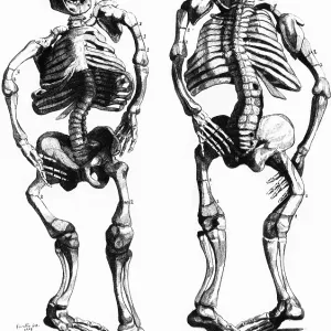 Malformed Skeletons