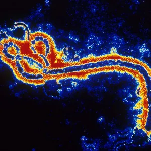 Medical Prints: Micrographs, LM, SEM, TEM