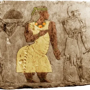 Muscular Dystrophy, Ancient Egypt Muscular Dystrophy, Ancient Egypt