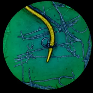 Nematode Snared by Predatory Fungus (LM) under a microscope