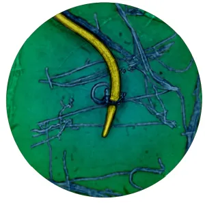 Nematode Snared by Predatory Fungus (LM) under a microscope