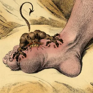 The Pain of Gout, 1799