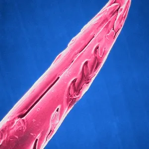 SEM of honeybee stinger