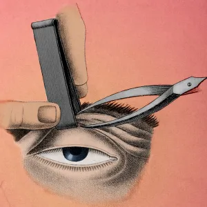 Surgery to Correct Lazy Eyelid, 1830