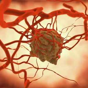 Tumor, artwork