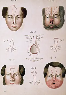 Instruction Prints: 19th Century Facial Reconstruction