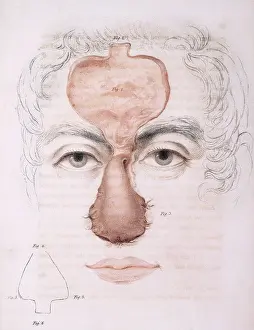 Instruction Prints: 19th Century Facial Reonstruction