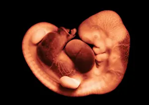 Fetal Prints: 35 day old human embryo