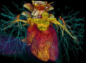 Spinal Prints: 3D CT Scan of Heart
