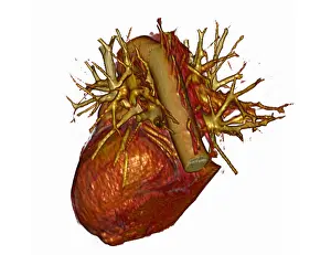 Trunk Prints: 3D CT Scan of Heart