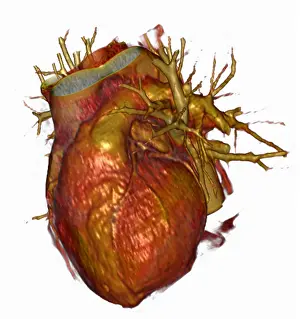 Trunk Prints: 3D CT Scan of Heart