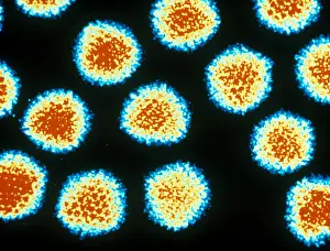 Histopathic Prints: Adenovirus, TEM