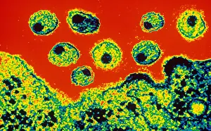 Histology Prints: AIDS Virus (TEM)