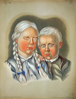 Pigment Prints: Albino Children, 19th Century