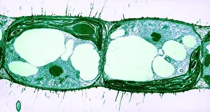 Algae Prints: Algae Cell Division, Cylindrocapsa brebissonii