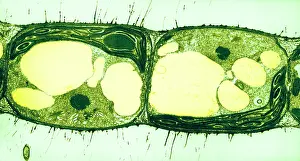 Algae Prints: Algae Cell Division, Cylindrocapsa brebissonii