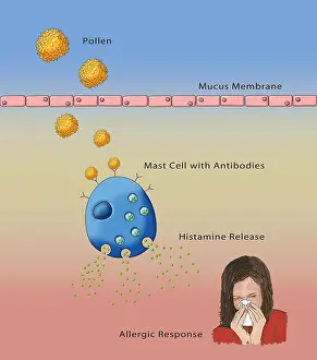 Pollen Prints: Allergic Response, Illustration