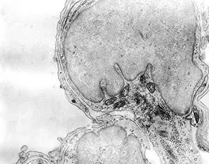Rats Prints: Alveolar capillary