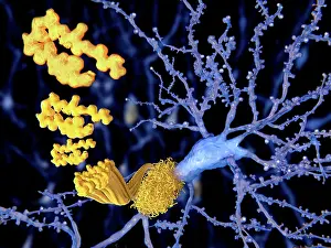 Pathological Prints: Alzheimer disease, the beta-amyloid peptid