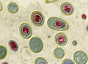 October Prints: Anthrax bacteria, Bacillus anthracis, TEM
