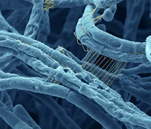 Sems Prints: Anthrax bacteria, Under the MIcroscope, SEM