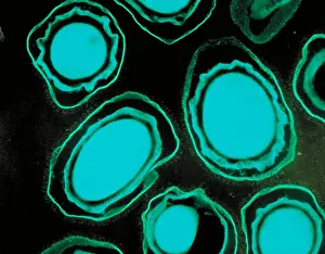 Bioterrorism Prints: Anthrax spores