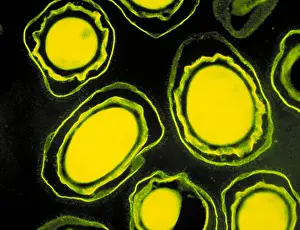 Bacteria Prints: Anthrax spores