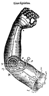 Combat Prints: Artificial Arm Designed by Ambroise Pare, 1564