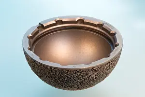Surgery Prints: Artificial Hip Joint Socket