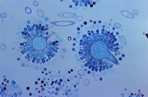 Micrograph Prints: Aspergillus mold Spores (LM) under a microscope