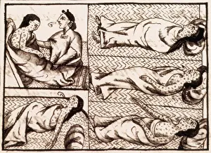 Codex Prints: Aztecs Dying of Smallpox, 16th Century