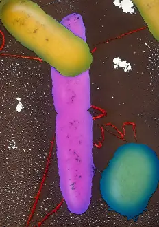 Prokaryote Prints: Bacterial Conjugation, TEM