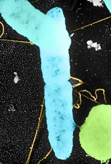 Prokaryote Prints: Bacterial Conjugation, TEM