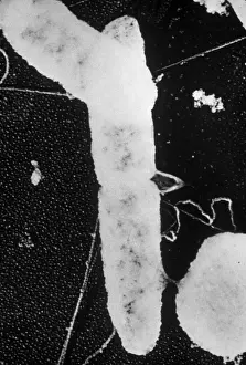 Prokaryote Prints: Bacterial Conjugation, TEM