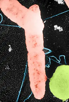 Prokaryote Prints: Bacterial Conjugation, TEM