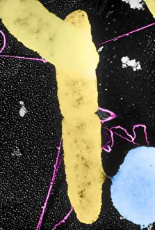 Microorganisms Prints: Bacterial Conjugation, TEM