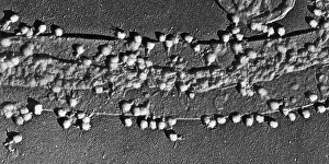 Gram Prints: Bacteriophage T-2 Infecting E. coli Cell Wall, TEM