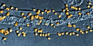 Gram Prints: Bacteriophage T-2 Infecting E. coli Cell Wall, TEM