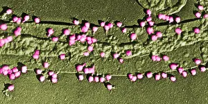Gram Prints: Bacteriophage T-2 Infecting E. coli Cell Wall, TEM
