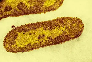 Gram Prints: Bacteriophage T-2 Infecting Escherichia coli, TEM